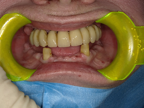 FOTO-1
