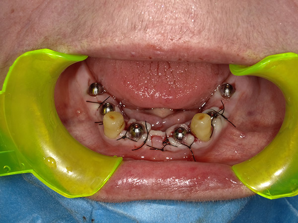 FOTO-3